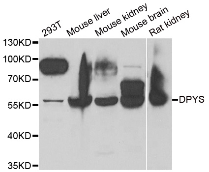 Western blot analysis of extracts of various cell lines, using DPYS antibody.