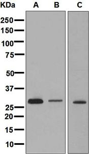 Western blot analysis on (A) fetal liver, (B) human heart, and (C) human testis lysates using anti-CLIC2 antibody.