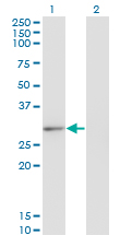 Western Blot analysis of CLIC2 expression in transfected 293T cell line by CLIC2 monoclonal antibody (M01), clone 2C1.Lane 1: CLIC2 transfected lysate (Predicted MW: 28.4 KDa).Lane 2: Non-transfected lysate.