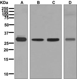 Western blot analysis on (A) JAR, (B) rat kidney, (C) mouse kidney, and (D) fetal kidney lysates using anti-CLIC3 antibody.