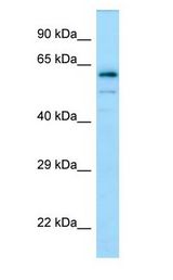 DPYSL4 / CRMP3 antibody Western Blot of Human brain.
