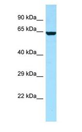 DPYSL4 / CRMP3 antibody Western Blot of 721_B cell lysate. DPYSL4 is strongly supported by BioGPS gene expression data to be expressed in Human 721_B cells.