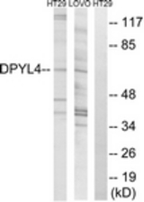 Western blot of extracts from LOVO/HT-29 cells, using DPYSL4 Antibody. The lane on the right is treated with the synthesized peptide.