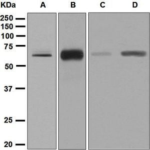Western blot analysis on (A) SH-SY5Y, (B) Neuro-2a, (C) U87-MG, and (D) human cerebellum lysates using anti-CRMP-3 antibody.
