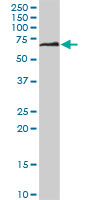 DPYSL5 monoclonal antibody (M04), clone 2D10. Western blot of DPYSL5 expression in rat brain.