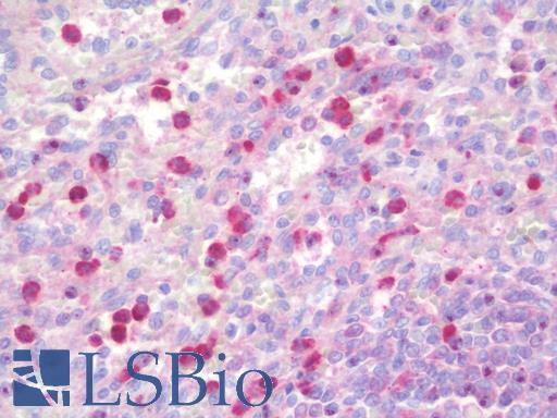 Anti-DQX1 antibody IHC staining of human spleen. Immunohistochemistry of formalin-fixed, paraffin-embedded tissue after heat-induced antigen retrieval. Antibody LS-B9741 concentration 10 ug/ml.