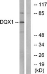 Western blot of extracts from COS7 cells, using DQX1 Antibody. The lane on the right is treated with the synthesized peptide.