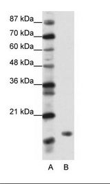 A: Marker, B: Transfected 293T Cell Lysate