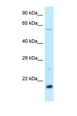 DR1 antibody LS-C145911 Western blot of Mouse Kidney lysate. Antibody concentration 1 ug/ml.