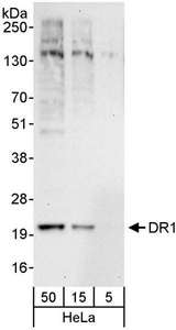 Detection of Human DR1 by Western Blot. Samples: Whole cell lysate (5, 15 and 50 ug) from HeLa cells. Antibodies: Affinity purified rabbit anti-DR1 antibody used for WB at 1 ug/ml. Detection: Chemiluminescence with an exposure time of 30 seconds.