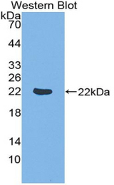Western blot of recombinant DR1.