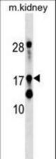 DR1 Antibody western blot of mouse kidney tissue lysates (35 ug/lane). The DR1 antibody detected the DR1 protein (arrow).