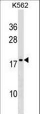 DR1 Antibody western blot of K562 cell line lysates (35 ug/lane). The DR1 antibody detected the DR1 protein (arrow).