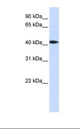 293T cell lysate. Antibody concentration: 1.0 ug/ml. Gel concentration: 12%.