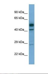 Western blot of Human Fetal Heart. STK17A antibody dilution 1.0 ug/ml.