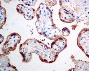 IHC of paraffin-embedded human placenta tissue using anti-CLIC3 antibody.