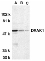 Western blot of DRAK1 in MOLT4 (A), A431 (B), and 3T3 (C) whole cell lysates with DRAK1 antibody at 1 ug/ml.