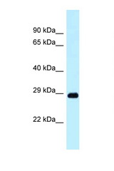 DRAM1 / DRAM antibody LS-C145976 Western blot of Small Intestine lysate. Antibody concentration 1 ug/ml.