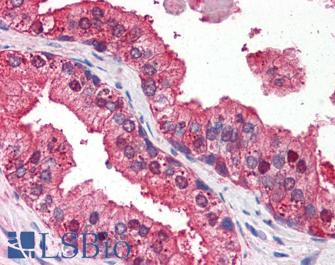 Anti-DRAM1 / DRAM antibody IHC of human prostate. Immunohistochemistry of formalin-fixed, paraffin-embedded tissue after heat-induced antigen retrieval. Antibody LS-B2726 concentration 3 ug/ml.