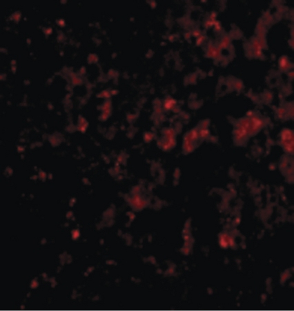 Immunofluorescence of DRAM in Human Liver cells with DRAM antibody at 20 ug/ml.