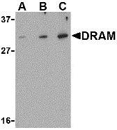 Western blot of DRAM in K562 cell lysate with DRAM antibody at (A) 0.5, (B) 1 and (C) 2 ug/ml.