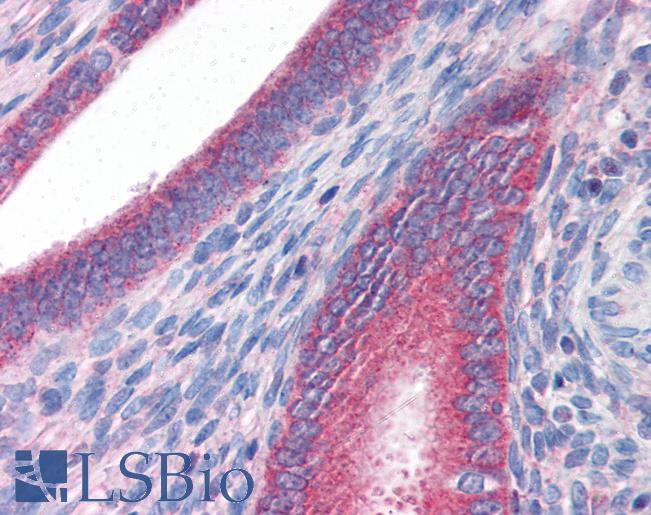 Anti-DRAM1 / DRAM antibody IHC of human uterus. Immunohistochemistry of formalin-fixed, paraffin-embedded tissue after heat-induced antigen retrieval. Antibody LS-B2725 concentration 3 ug/ml.