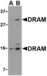 Western blot of DRAM in 293 cell lysate with DRAM antibody at (A) 0.5 and (B) 1 ug/ml.