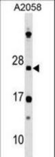 DRAP1 Antibody western blot of A2058 cell line lysates (35 ug/lane). The DRAP1 antibody detected the DRAP1 protein (arrow).