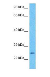 Western blot of CLIC3 Antibody with human Fetal Lung lysate.