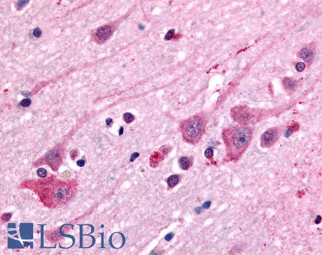 Anti-DRD1 antibody LS-A42 IHC of human brain. Immunohistochemistry of formalin-fixed, paraffin-embedded tissue after heat-induced antigen retrieval.