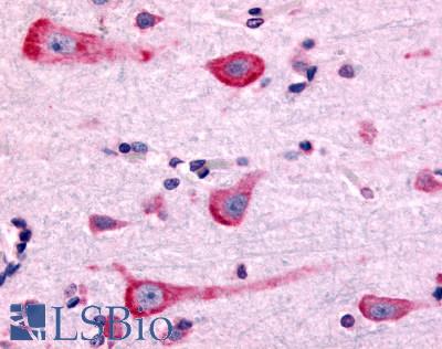 Anti-DRD2 antibody LS-A1403 IHC of human brain, neurons and glia. Immunohistochemistry of formalin-fixed, paraffin-embedded tissue after heat-induced antigen retrieval.