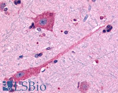 Anti-DRD2 antibody LS-A1405 IHC of human brain, neurons and glia. Immunohistochemistry of formalin-fixed, paraffin-embedded tissue after heat-induced antigen retrieval.