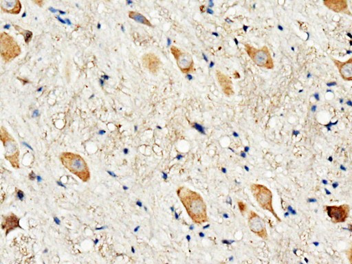 DRD3 / Dopamine Receptor D3 antibody. IHC(P): Rat Brain Tissue.