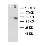 WB of DRD3 / Dopamine Receptor D3 antibody. Lane 1: Rat Testis Tissue Lysate. Lane 2: Rat Brain Tissue Lysate.