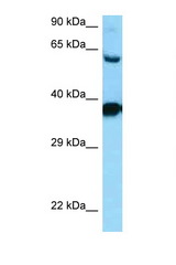 DRD3 / Dopamine Receptor D3 antibody LS-C146243 Western blot of HepG2 Cell lysate. Antibody concentration 1 ug/ml.