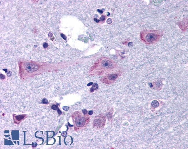 Anti-DRD3 / Dopamine Receptor D3 antibody LS-A1398 IHC of human brain, cortex. Immunohistochemistry of formalin-fixed, paraffin-embedded tissue after heat-induced antigen retrieval.