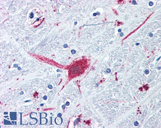 Anti-DRD3 / Dopamine Receptor D3 antibody LS-A1402 IHC of human brain, globus pallidus. Immunohistochemistry of formalin-fixed, paraffin-embedded tissue after heat-induced antigen retrieval.