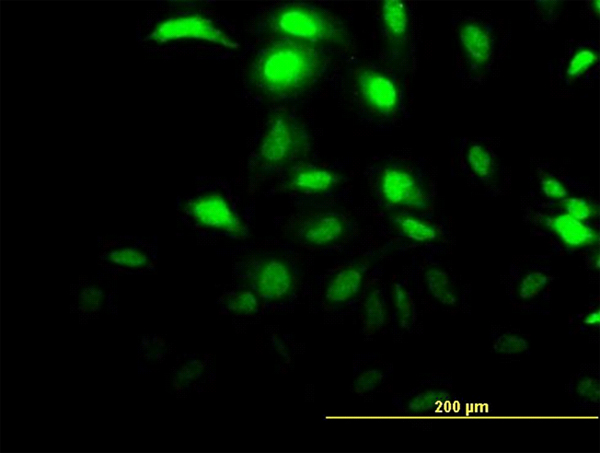 Immunofluorescence of monoclonal antibody to CLIC3 on HeLa cell (antibody concentration 15 ug/ml).