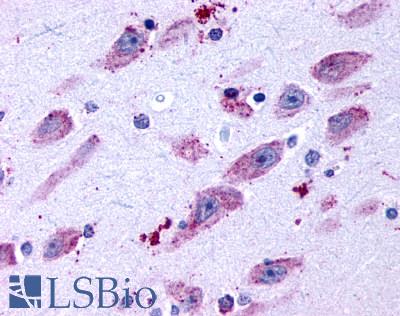 Anti-DRD4 / Dopamine Receptor D4 antibody LS-A3921 IHC of human brain, neurons and glia. Immunohistochemistry of formalin-fixed, paraffin-embedded tissue after heat-induced antigen retrieval.
