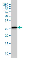 CLIC3 monoclonal antibody (M02), clone 3F8 Western blot of CLIC3 expression in A-431.