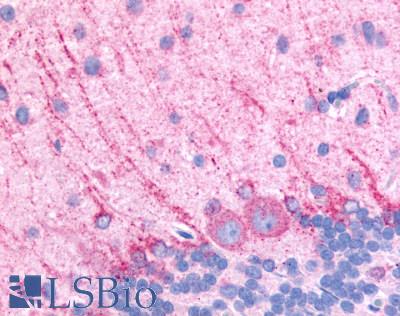 Anti-DRD5 / Dopamine Receptor D5 antibody LS-A1407 IHC of rat brain, Purkinje neurons. Immunohistochemistry of formalin-fixed, paraffin-embedded tissue after heat-induced antigen retrieval.