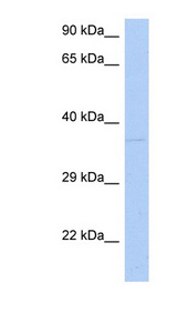 DRG1 antibody LS-C111172 Western blot of Fetal Spleen lysate.