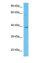 Western blot of DRG1 Antibody with human OVCAR-3 Whole Cell lysate.