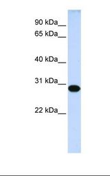 721_B cell lysate. Antibody concentration: 1.0 ug/ml. Gel concentration: 12%.