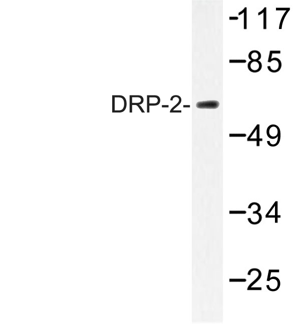 Western blot of DRP-2 (P510) pAb in extracts from A549 cells treated with EGF 200ng/ml 30'.
