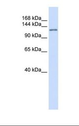 Placenta lysate. Antibody concentration: 1.0 ug/ml. Gel concentration: 6-18%.