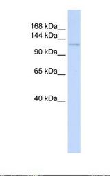 721_B cell lysate. Antibody concentration: 1.0 ug/ml. Gel concentration: 6-18%.