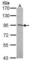 Sample (30 ug of whole cell lysate). A: A431 . 7.5% SDS PAGE. Desmocollin 2 / DSC2 antibody diluted at 1:500.