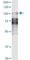 DSC2 monoclonal antibody (M14), clone 1F2. Western Blot analysis of DSC2 expression in human spleen.