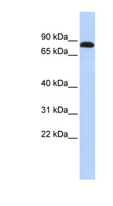 DSC3 / Desmocollin 3 antibody LS-C102163 Western blot of Jurkat lysate.